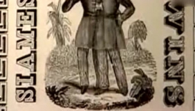 连体兄弟各自结婚娶妻生活在一起，共同生下21个孩子