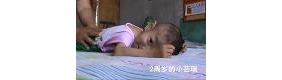 ‘折翼天使’两岁小云瑞患重病身陷生命边缘