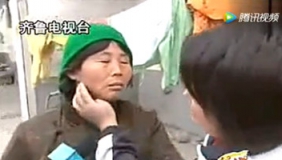 农村妇女两排牙齿封闭三十年，不能张口吃饭