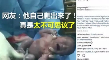 不可思议！婴儿靠自己从妈妈肚子里“爬”出