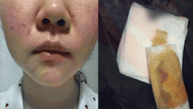 女子在医院停车场遭假警察袭击