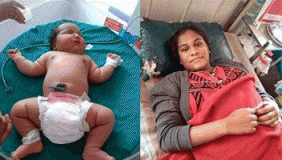 印度19岁女孩诞下世界最重女婴 出生重13.6斤