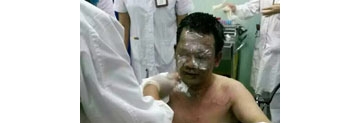 【拍客】广西：一医生遭患者泼汽油 头面部重度烧伤