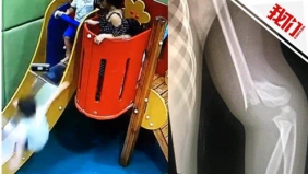 5岁男童被踹下滑梯骨折 肇事者母亲抱孩子溜了