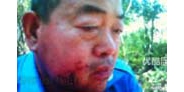 【拍客】济南抢占耕地拆迁队群殴村民 老汉被打掉牙齿