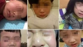 杭州：一幼儿园多名孩子眼睛被紫外线灯灼伤