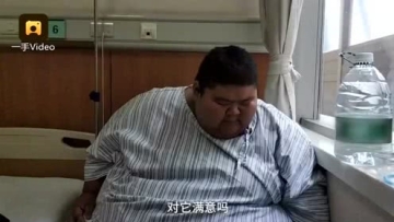 668斤的“山东第一胖”小伙切4/5胃减肥