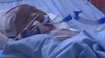 男孩遭后妈虐待重伤苏醒无望 养父哭称欲捐献其器官