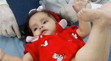 23岁年轻妈妈怀上“人鱼宝宝” 10万人中才有1例