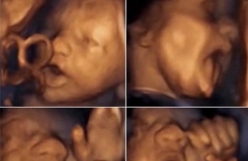 胎儿在子宫里听到音乐做“鬼脸” 吐长舌头