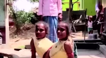 连体姐妹同时嫁给一个男人，老公还是个工程师