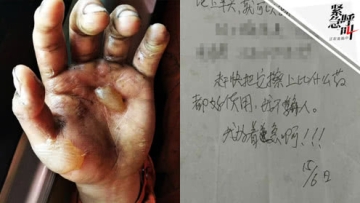 大兴安岭火场烫伤战士收到暖心药送药老人：赶紧擦上 我好着急啊