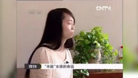 农村美女大学生一半脸青春美丽，另一半7岁就停止生长