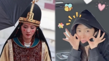 杨幂被烫伤后素颜出镜，脸部红肿一大片
