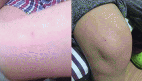 西安一幼儿园被曝胶带封嘴 针扎幼童