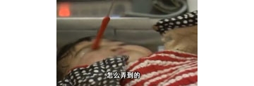 【拍客】江西：两岁多女童 眼睛插进一根针