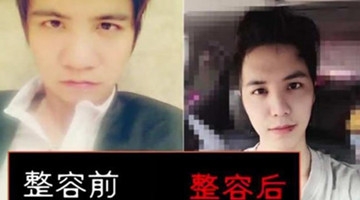 男子花260万想整成张翰 结果整成大张伟！