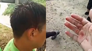 实拍残障人旅行团遭集体殴打：打的就是残障人!