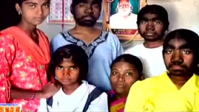 世界奇闻怪事之狼人，有点小怕怕