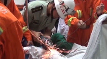 男子双腿被四根钢筋刺穿 消防员"手术"切割摘取