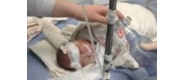 【拍客】少女北京街头产子后遗弃 医院抢救无效死亡