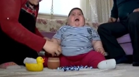 18个月的婴儿重64斤