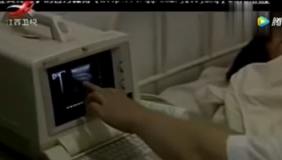 男子怀孕，手术成功取下18斤女婴