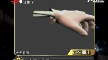 奇闻天下：长在腿上的手