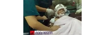 【拍客】5岁男童遭继母狠砍30刀 锁骨被砍断生命垂危