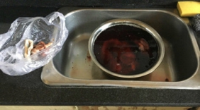 暗访北京胎盘黑市：加工如煮肉 每个卖千元