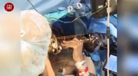 男子接受脑部手术 一边吹萨克斯“助兴”