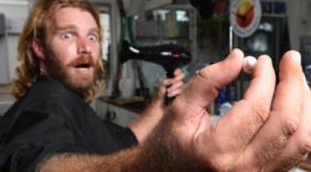 男子半年未理发 头发里竟然长出珍珠